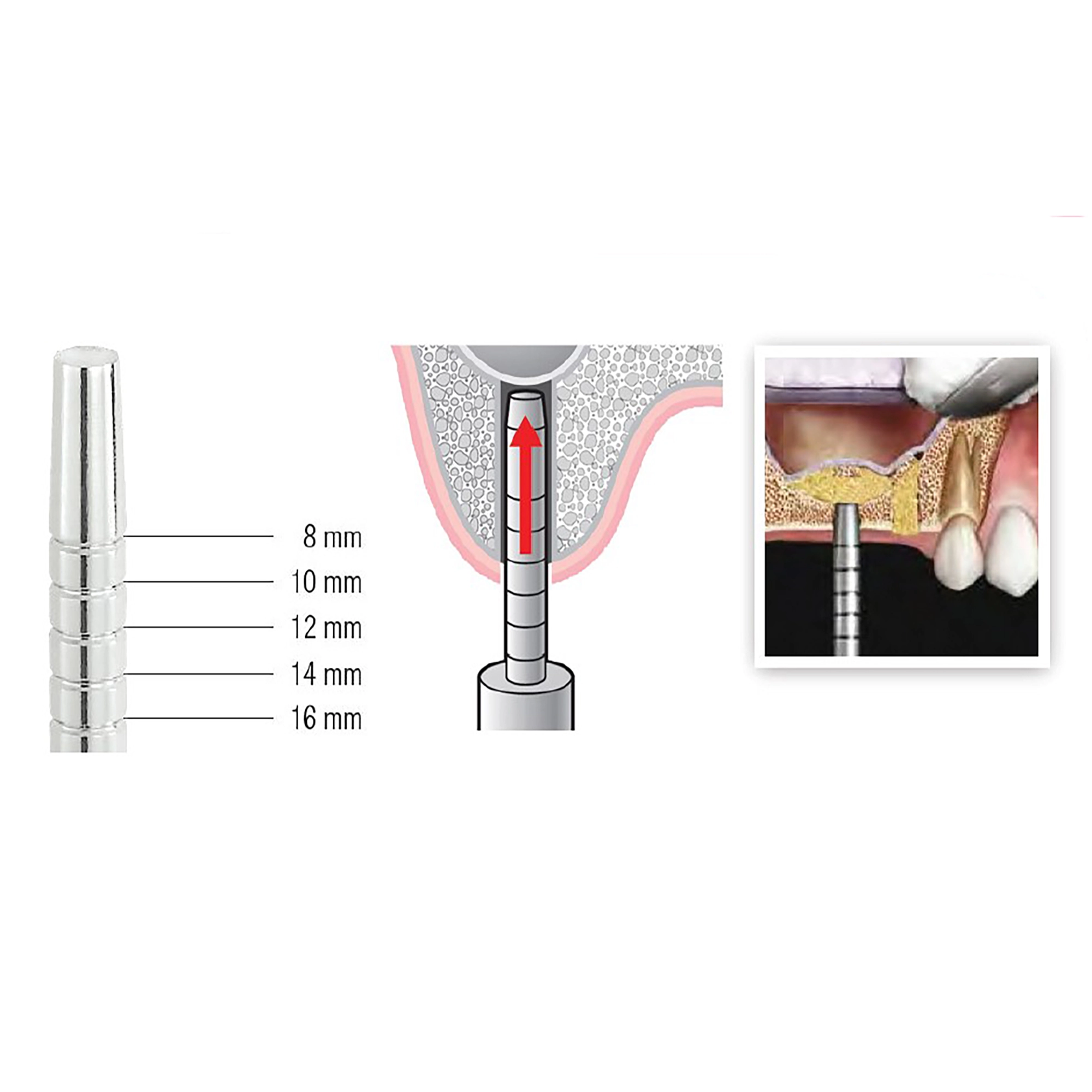 استئوتوم مستقیم دسته چکشی 3311S